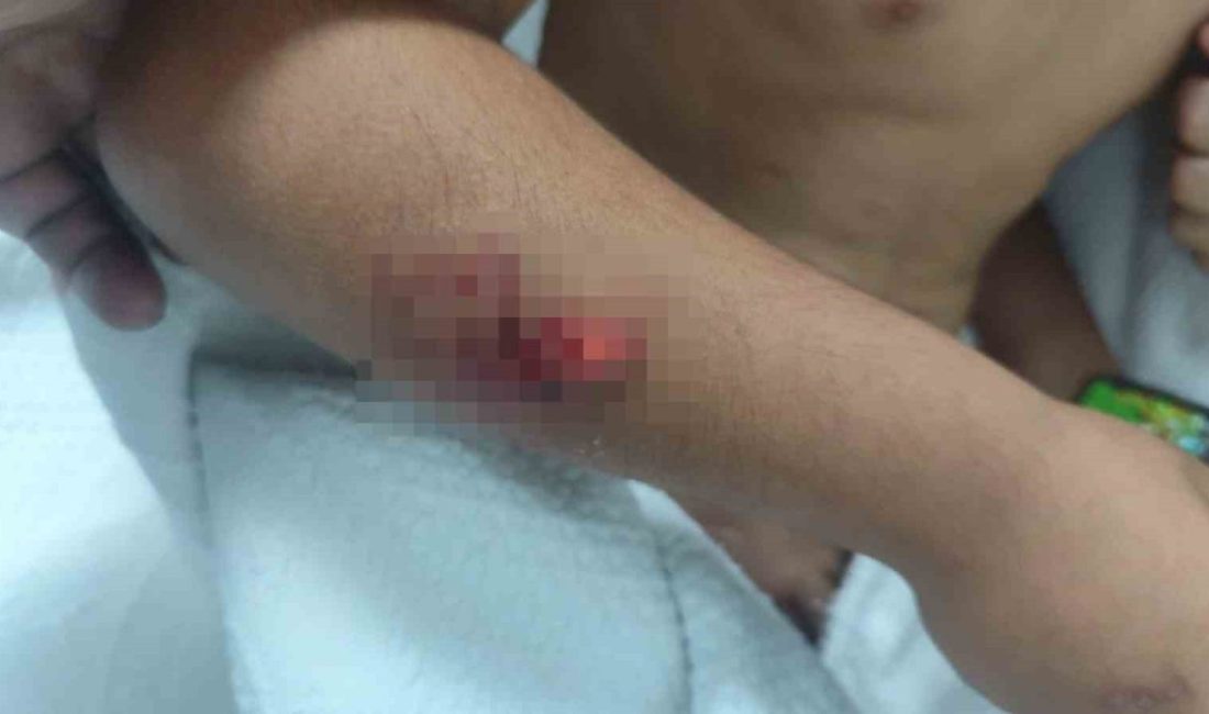 Şanlıurfa’nın Viranşehir ilçesinde okul çıkışı sokak köpeklerinin saldırısına uğrayan ilkokul