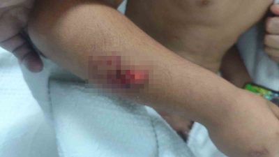 Şanlıurfa’nın Viranşehir ilçesinde okul çıkışı sokak köpeklerinin saldırısına uğrayan ilkokul